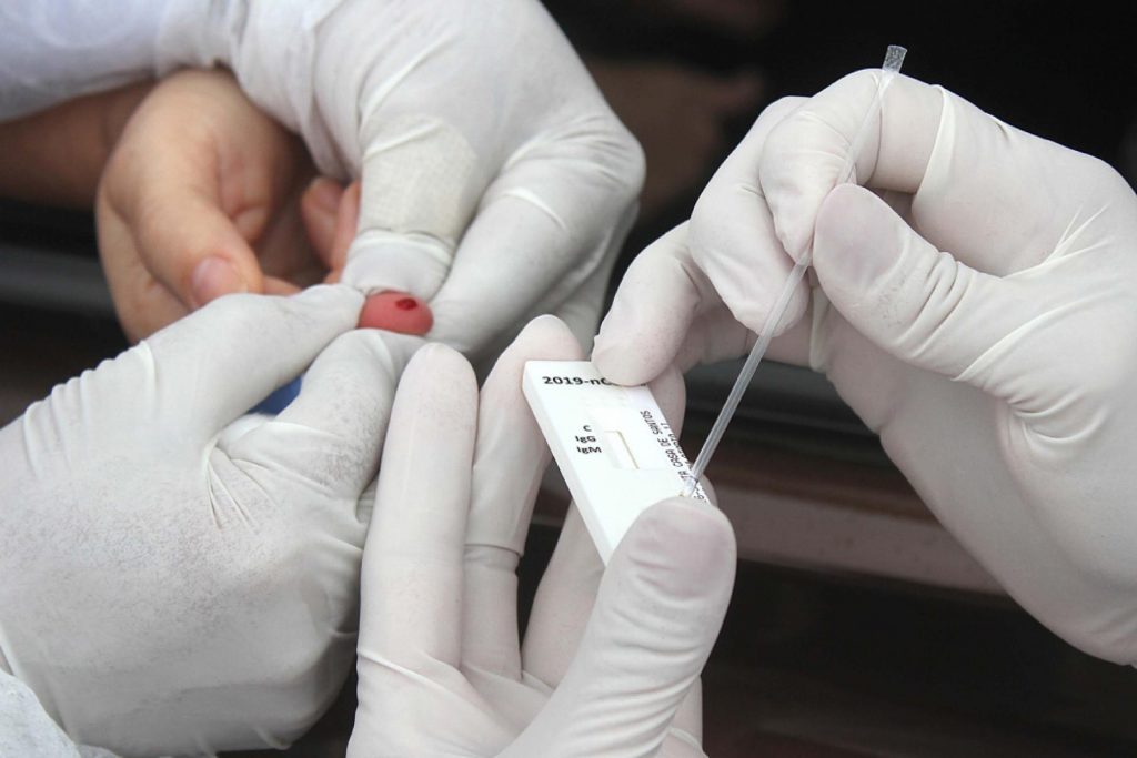 Secretaria de Saúde do DF abre pregão para compra de 1 milhão de testes rápidos
