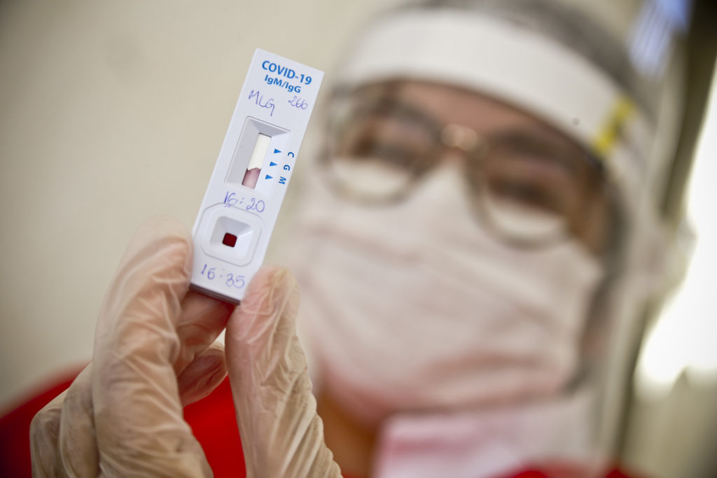 Testagem contra o Coronavírus passa a ser feita em todas as UBSs do DF