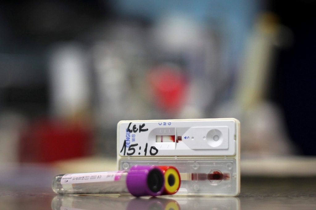 Após análise, Fiocruz libera 300 mil kits de testes rápidos doados ao GDF