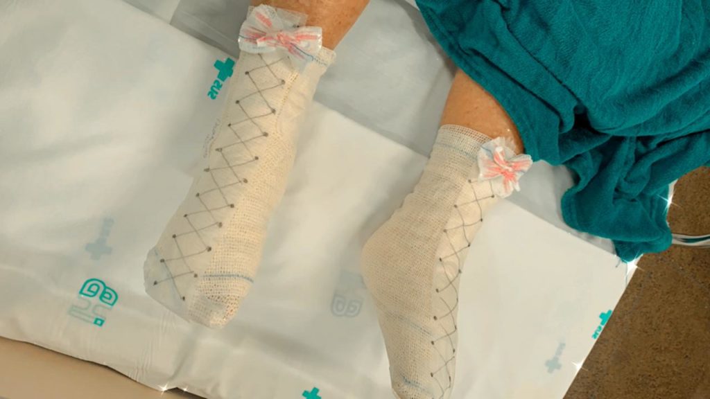 Curativos especiais elevam astral de paciente do Hospital de Base