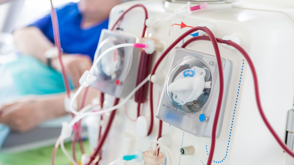 Oito em cada dez casos de pacientes renais poderiam ser evitados