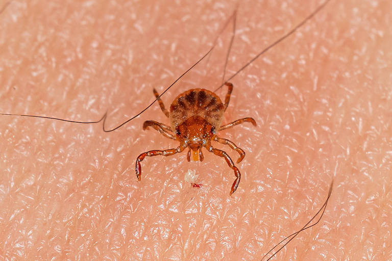 Mitos e Verdades sobre a febre maculosa: Veterinário do CEUB explica a ‘doença do carrapato’
