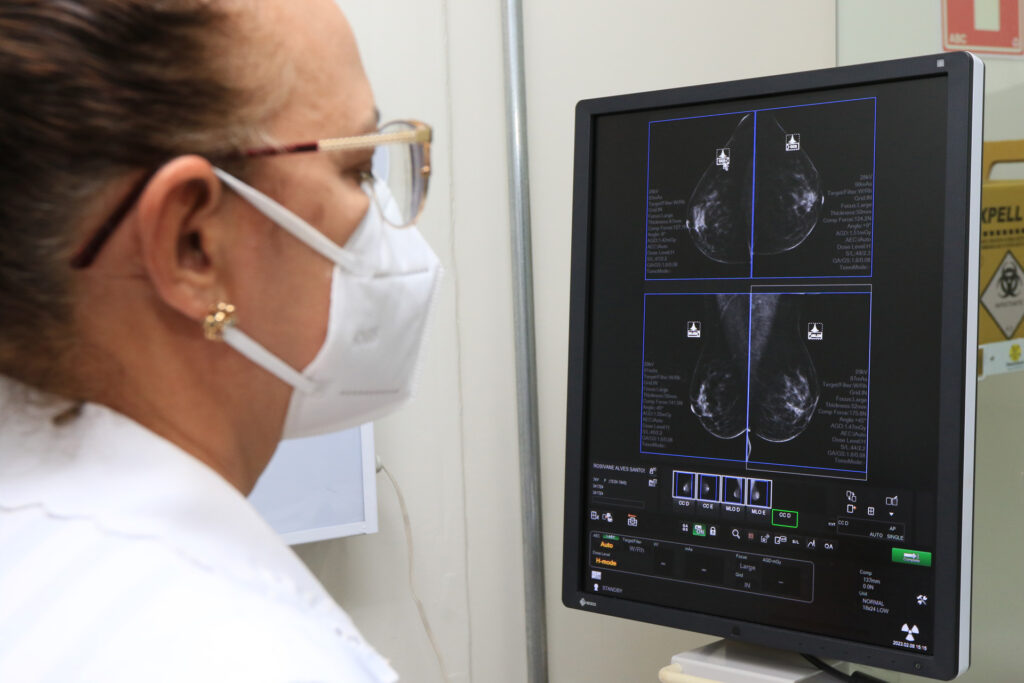 Governo Ibaneis integra unidades e zera lista de espera por mamografias