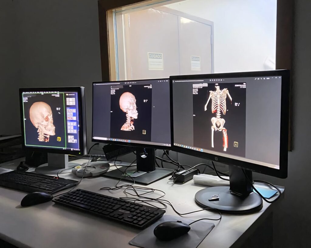 PCDF realiza treinamento em radiologia forense com uso de tomografia