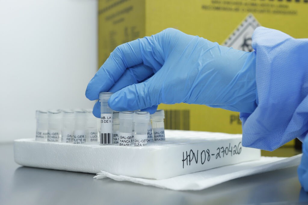 DF adota teste inovador para detecção precoce do HPV na rede pública